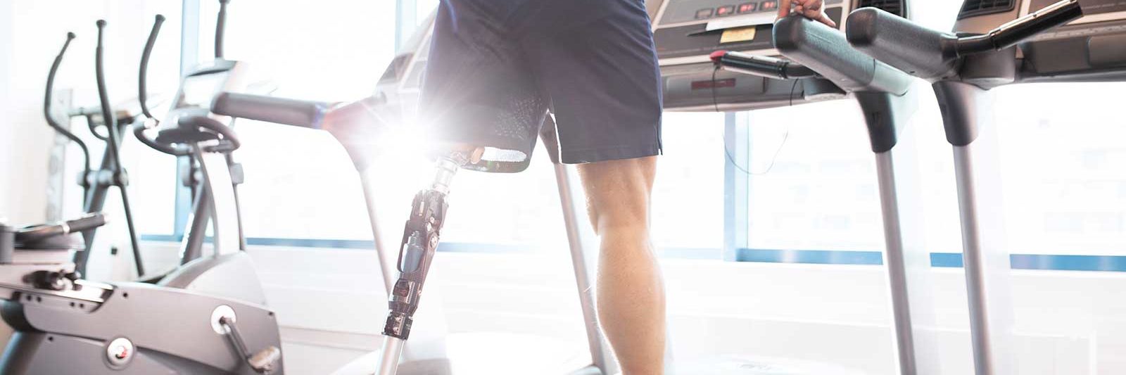 Amputee with Prothetic Leg on Treadmill